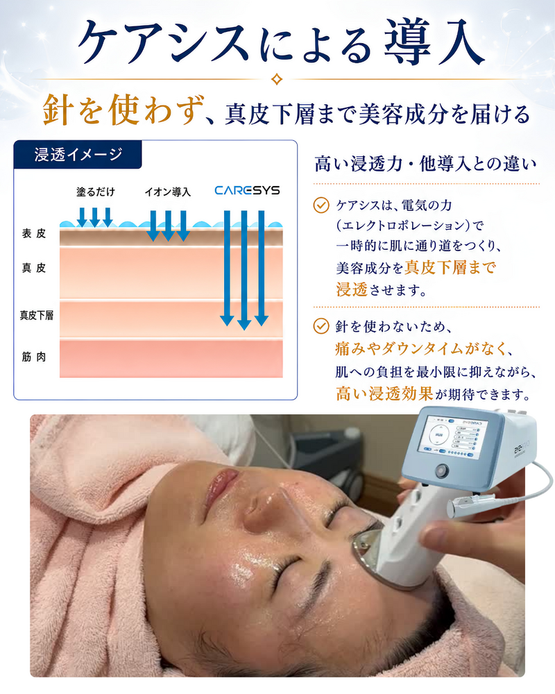 ケアシスによる導入