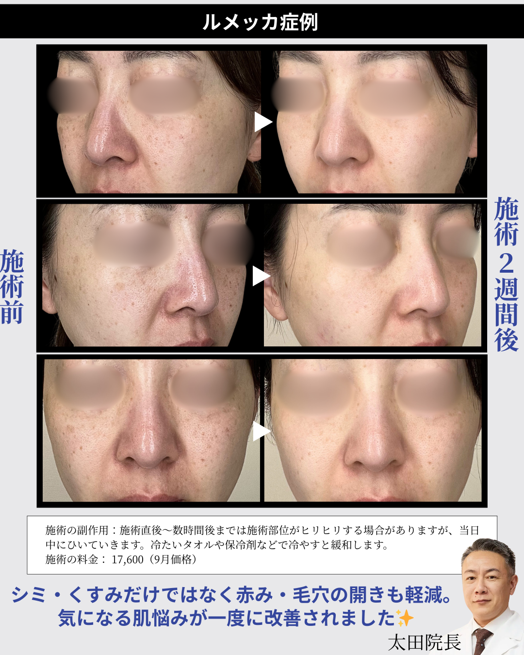 https://aak-clinic.com/recommendation/data/2a67d46dc8549732a8c7451997514608c4513a54.png